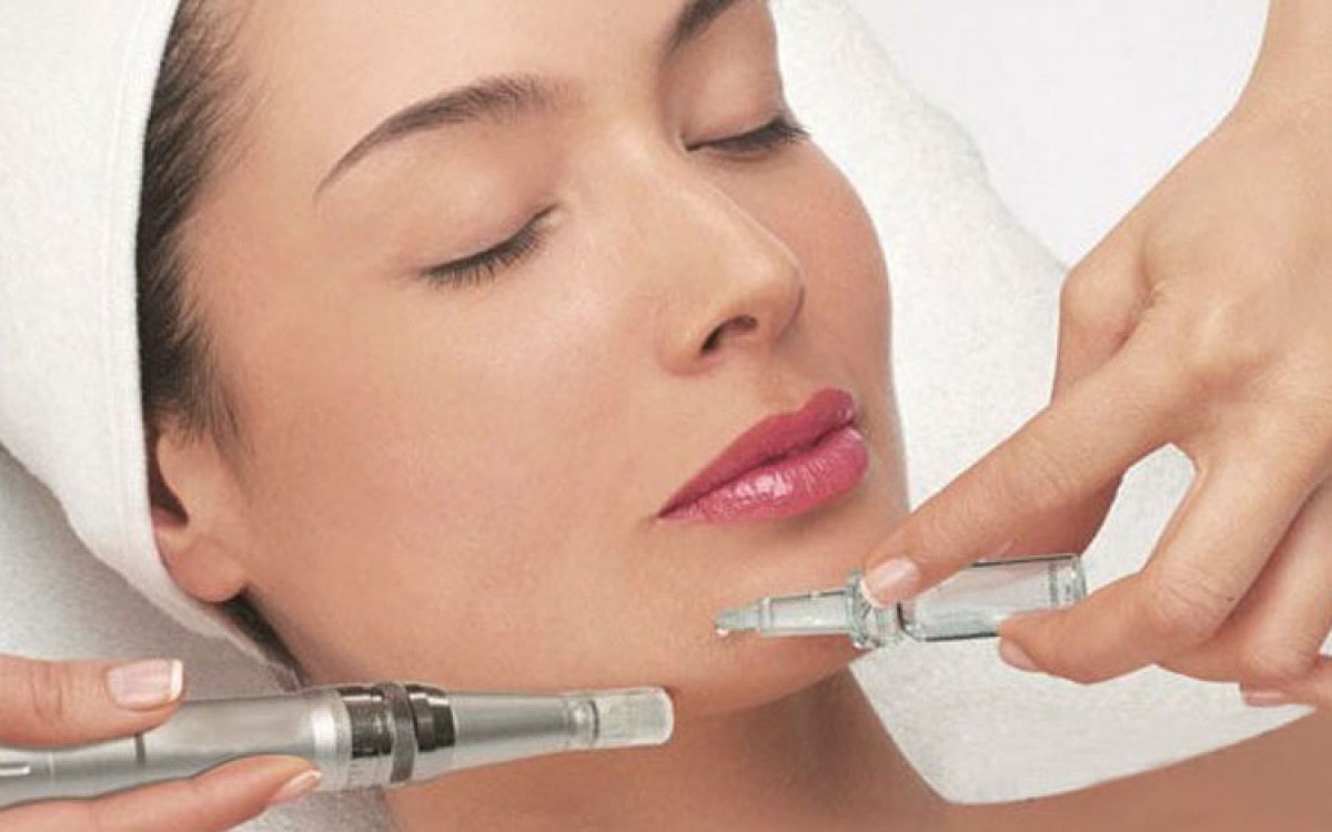 mezoterapia frakcyjna mikroiglowa lodz min.9d0ecb77 - Oferta 15